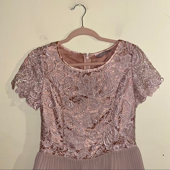 🦬A WEAR gorgeous lace top zip up mini dress 10 - Picture 3 of 7